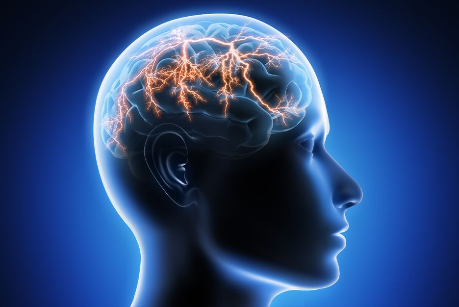  diagnosi Sindrome di Dravet 