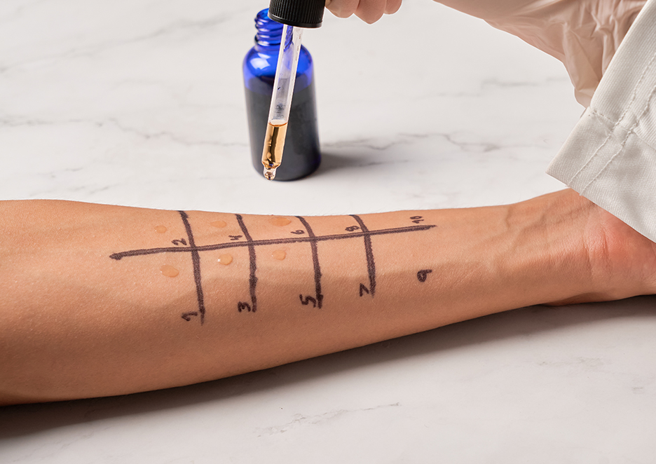 Diagnosi di orticaria
